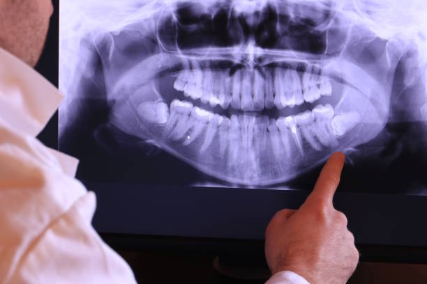 Best Emergency Treatment for Toothache in Bonney Lake, WA